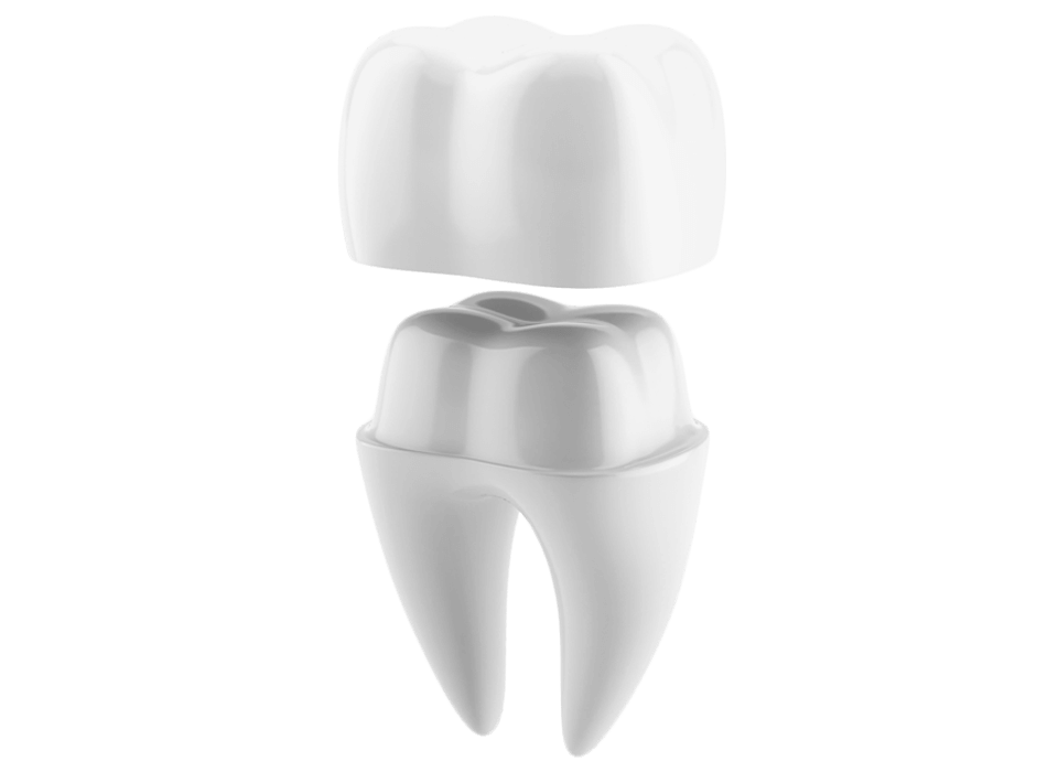 Dental Crowns Can Help Restore Your Tooth | Dallas, GA